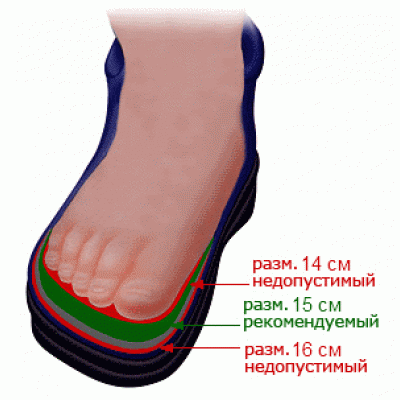 Размеры ортопедической обуви